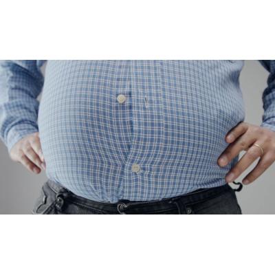 Por qué la obesidad no tiene que ver solo con comer mucho y moverse poco