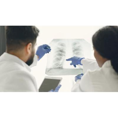 Identifican una clave inmunológica que explica el riesgo de neumonía grave tras la gripe