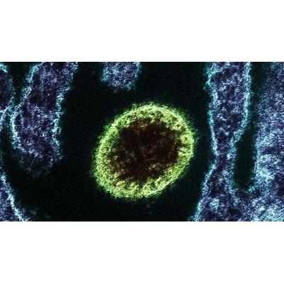 Las claves del virus Nipah, de riesgo "muy bajo" en el Estado español