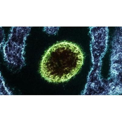 ¿Es posible que el virus Nipah llegue a Europa?