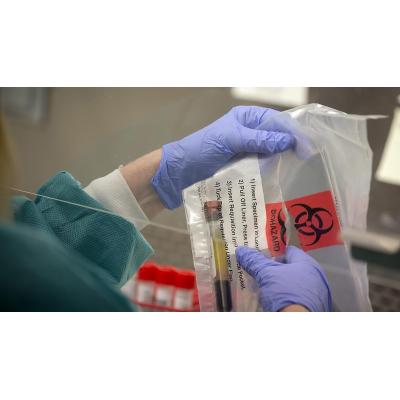 Los vacunados pueden infectarse de sarampión y uno solo podría contagiar a otros 20