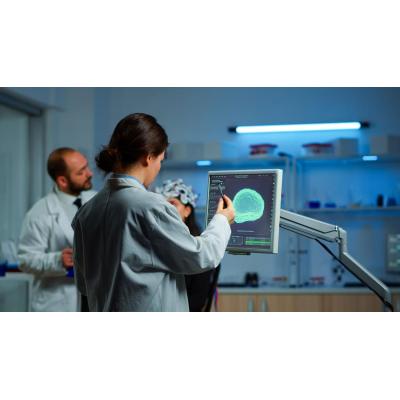 Desarrollan una plataforma que mejora con IA el diagnóstico e investigación sobre la epilepsia