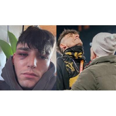 Tres hombres agreden en su casa al árbitro que pidió matrimonio a su novio en un partido de fútbol
