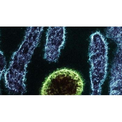 Sanidad afirma que la probabilidad de detectar un caso autóctono del virus Nipah en el Estado español "es remota"