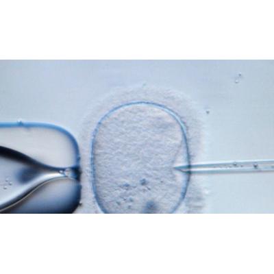 La testosterona podría no mejorar los resultados de la fecundación 'in vitro'