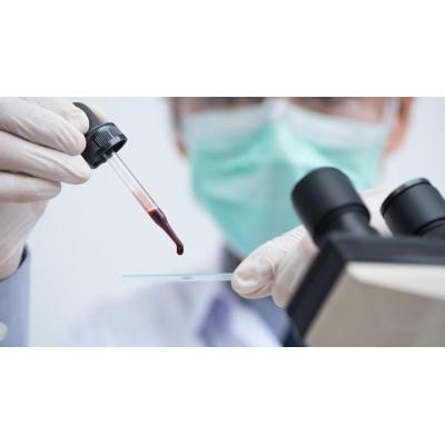 Un nuevo método avanza hacia la detección del cáncer con un análisis de sangre