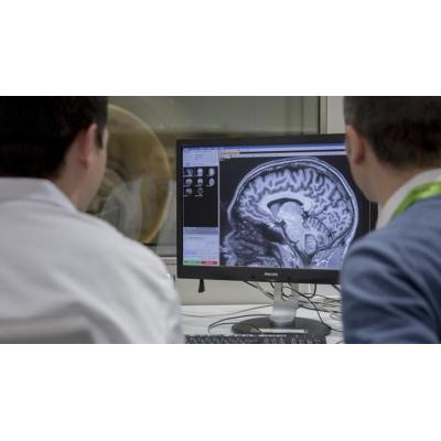 Científicos revelan cómo el entorno acelera o frena el envejecimiento del cerebro