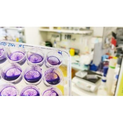 Científicos vascos avanzan en nuevas estrategias terapéuticas para el síndrome de Leigh