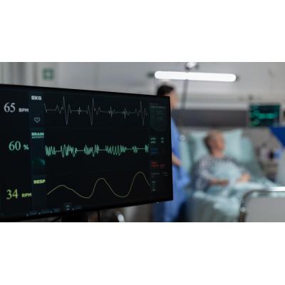 Tanto la frecuencia cardíaca muy baja como la muy alta está asociada con el riesgo de sufrir un derrame cerebral