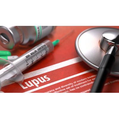 Navarra registra 1.200 personas con lupus y la mitad sufre "neblina mental"