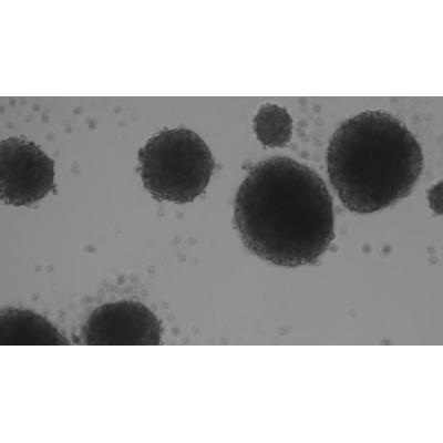 Diseñan un método para activar con luz una molécula que elimina células madre del cáncer de mama