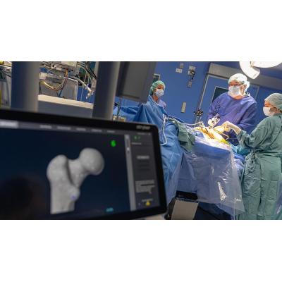 Una nueva cirugía robótica de la Clínica Universidad de Navarra mejora la seguridad y precisión en la implantación de prótesis de rodilla y cadera