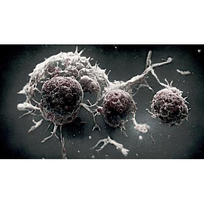 Un estudio logra una "marcada regresión" en cáncer de pulmón degradando la proteína KRAS