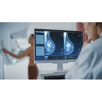 La inflamación inducida por quimioterapia puede actuar como marcador de resistencia terapéutica en cáncer de mama
